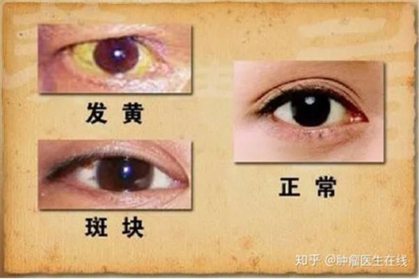 有什么症状