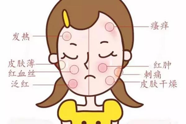 皮肤干燥的原因