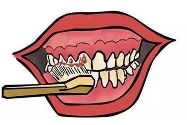 牙龈一碰就出血
