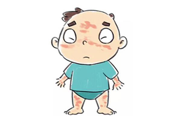 有什么症状