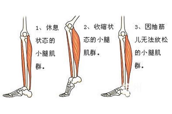 如何拉伸小腿肌肉