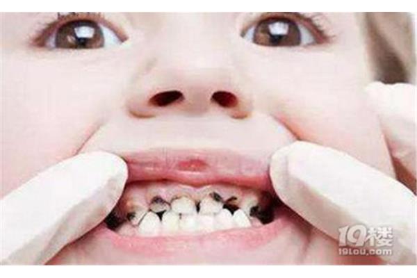 小孩牙痛怎么办