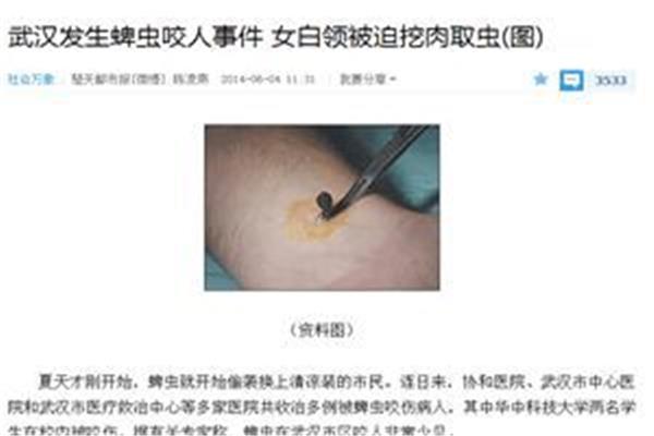 蜱虫怎么预防