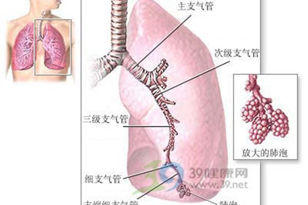 支气管炎鉴别诊断