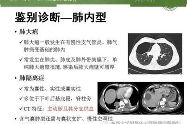 支气管炎鉴别诊断