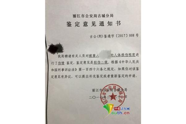 人体伤残鉴定标准