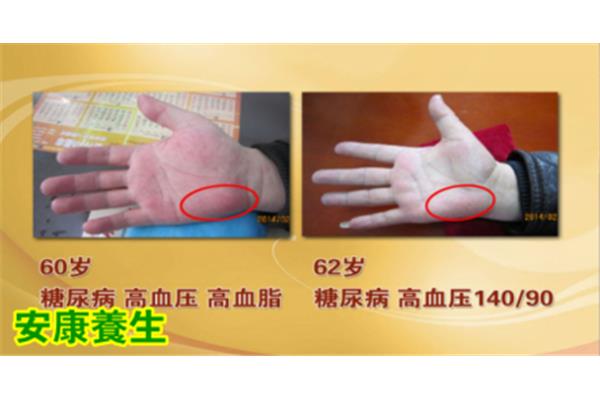 燥热的症状