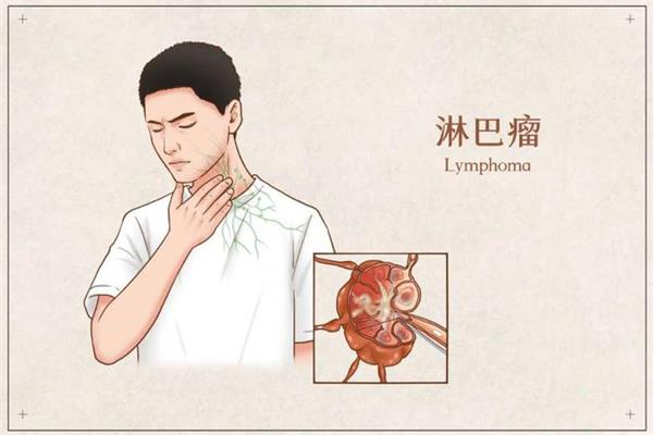 燥热的症状