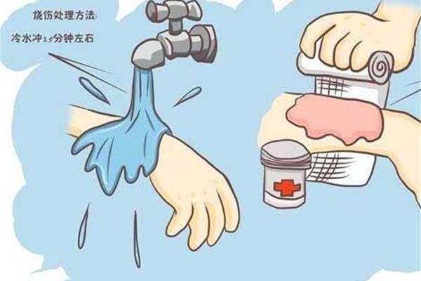 烫伤的处理方法