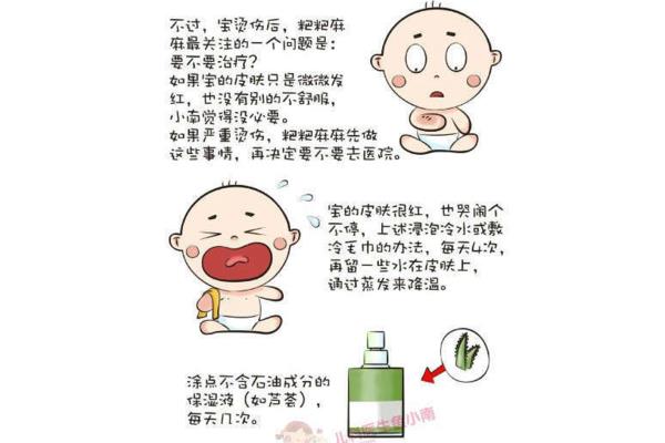 烫伤的处理方法