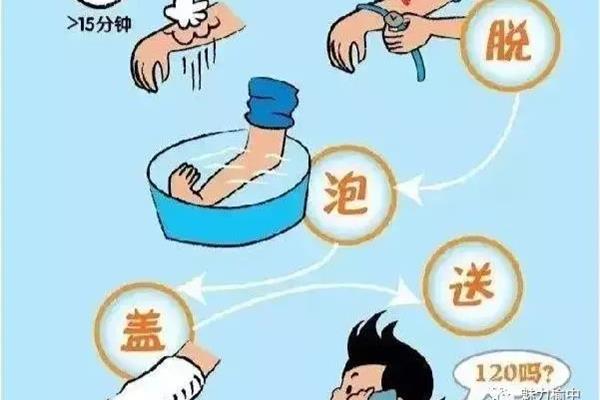 烫伤的处理方法