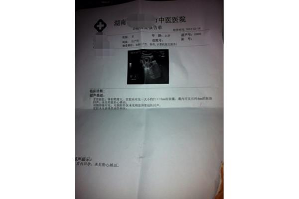 死胎有什么症状