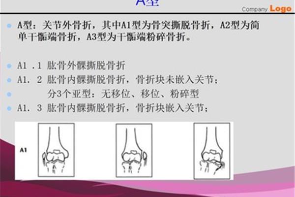 骨折的治疗原则