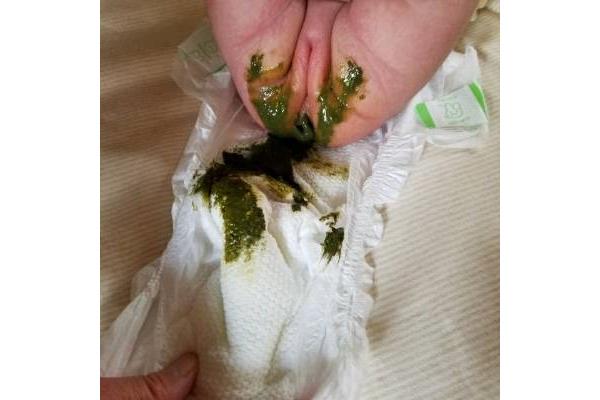 婴儿拉绿屎