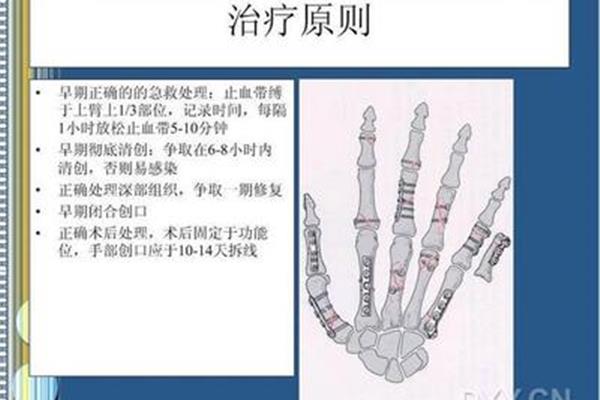 创伤急救的原则