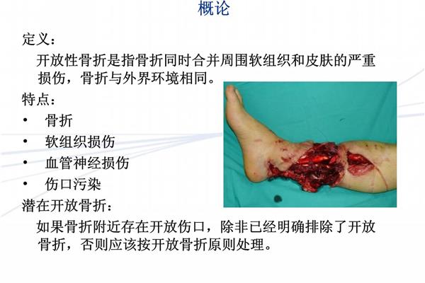 骨折的治疗原则