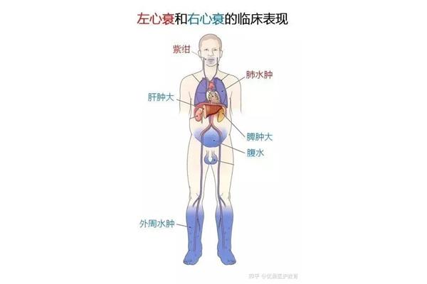 左心衰的临床表现