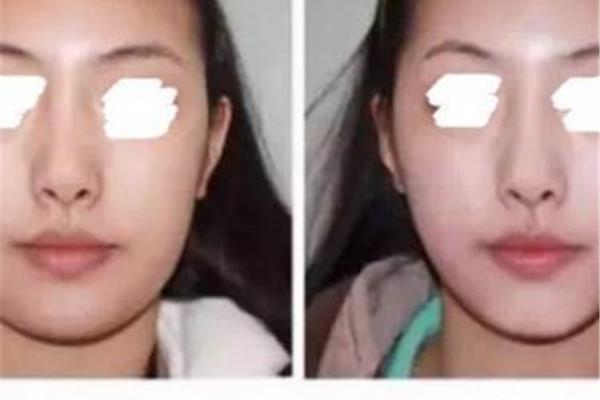 如何让脸变瘦