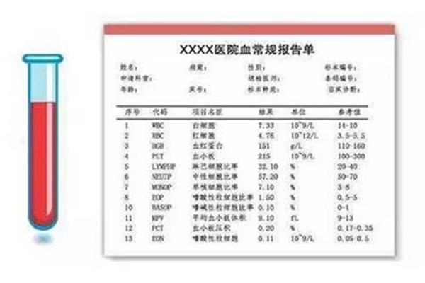 血常规是否空腹