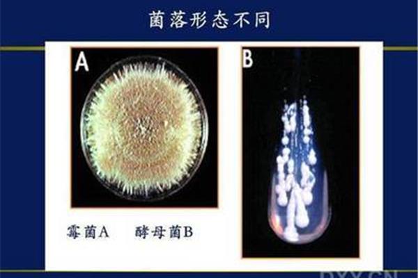 酵母菌感染