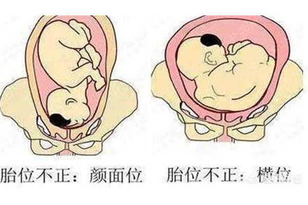 胎儿多少周入盆
