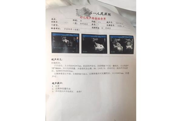 一般怀孕几个月生