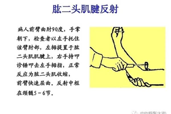 跟腱反射检查方法