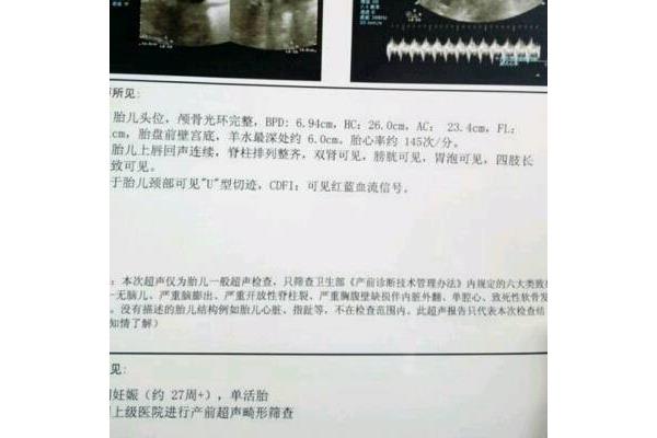 hc什么意思