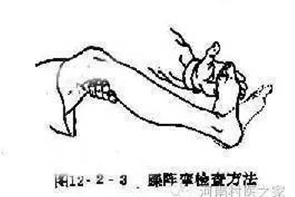 跟腱反射检查方法