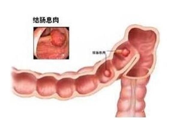 阴道的结构图