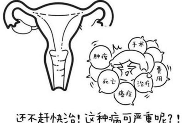 盆腔积液多少正常