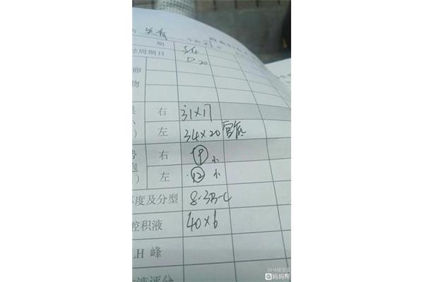 盆腔积液多少正常