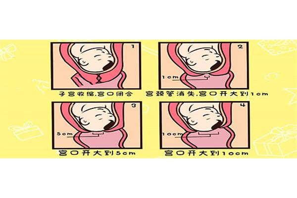 临产是什么意思