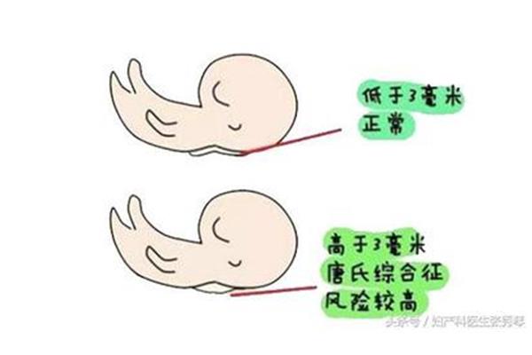 肚子为什么会叫