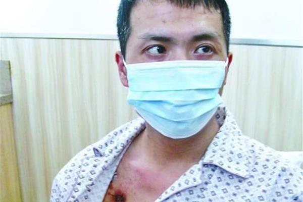 开胸验肺事件