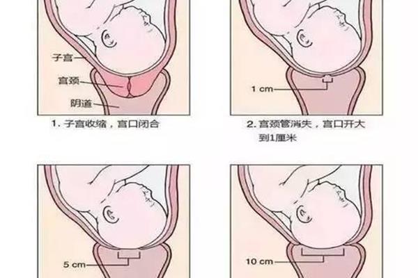 临产是什么意思