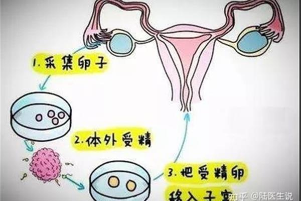 人工受孕流程