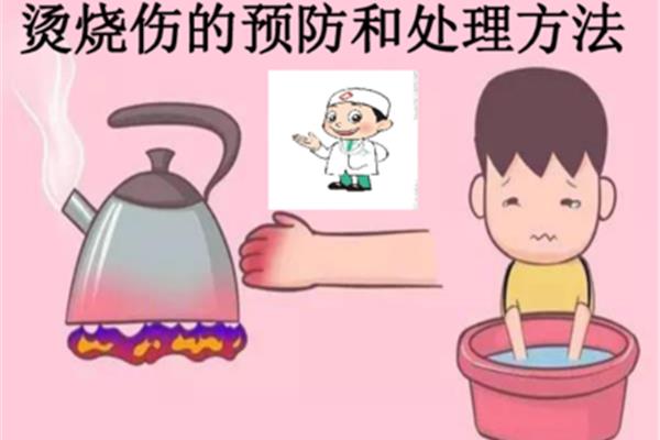 烧伤后怎么办