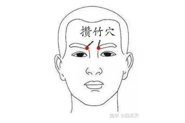 太阳穴上方疼