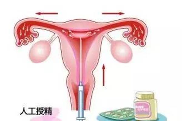 人工受孕流程