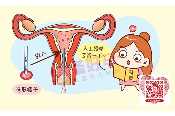 人工受孕流程