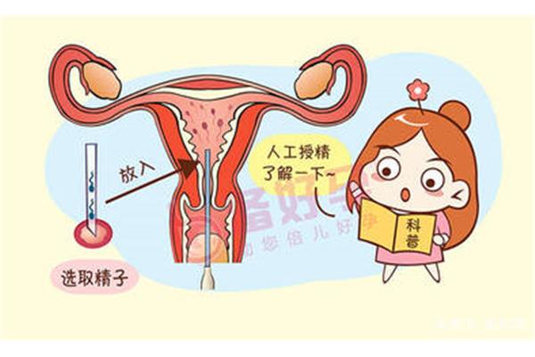 人工受孕流程