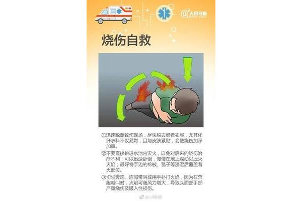 烧伤后怎么办