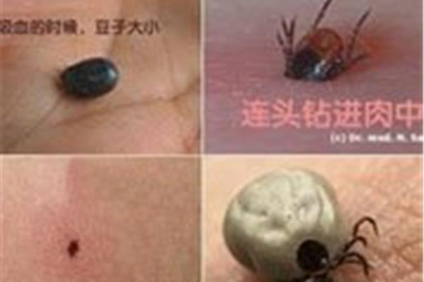 蜱虫有毒吗