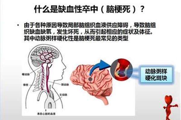 什么是溶栓治疗