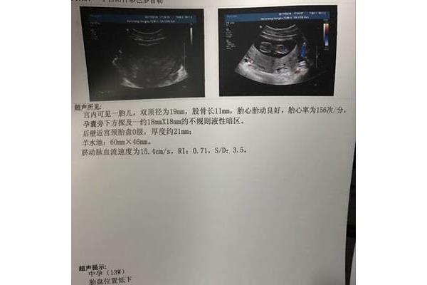 三个月有胎动吗