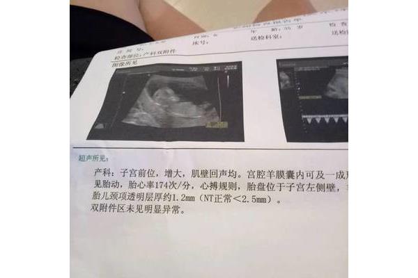 三个月有胎动吗