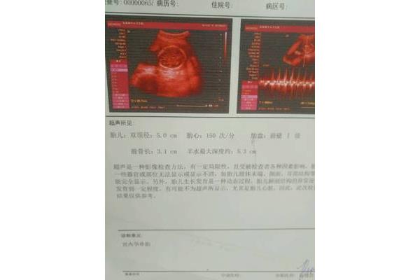 三个月有胎动吗