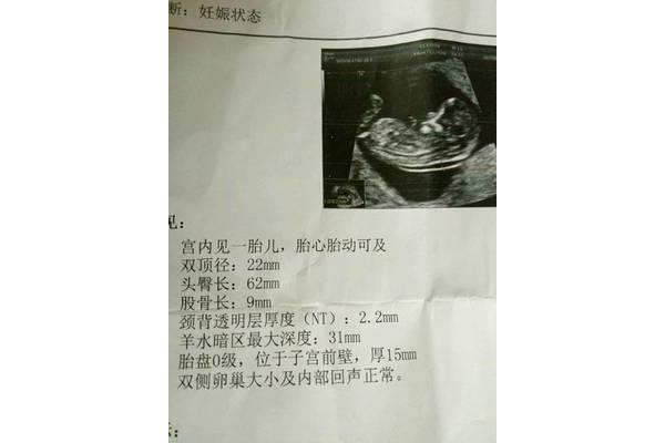 三个月有胎动吗
