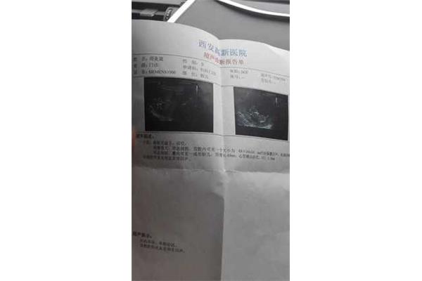 三个月有胎动吗